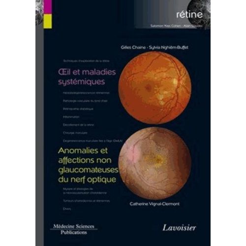 Rétine - Volume 5, Oeil Et Maladies Systémiques - Anomalies Et Affections Non Glaucomateuses Du Nerf Optique