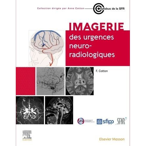 Imagerie Des Urgences Neuro-Radiologiques