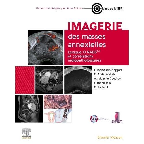 Imagerie Des Masses Annexielles - Lexique O-Rads Et Corrélations Radiopathologiques