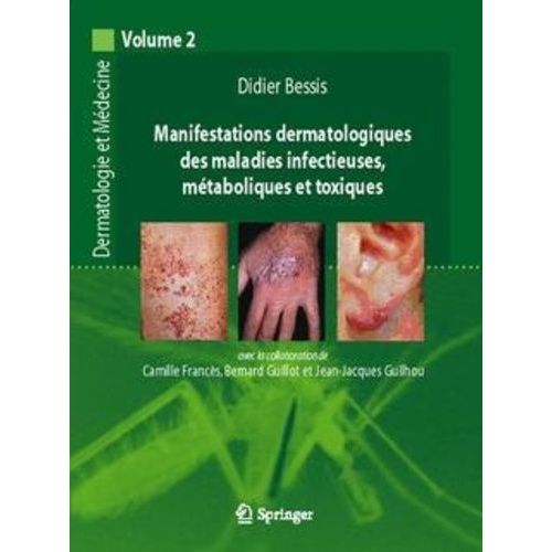 Manifestations Dermatologiques Et Maladies Infectieuses, Métaboliques Et Toxiques