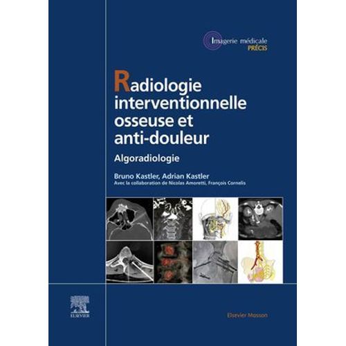 Radiologie Interventionnelle Osseuse Et Anti-Douleur