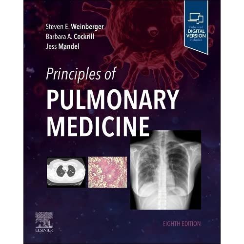 Principles Of Pulmonary Medicine