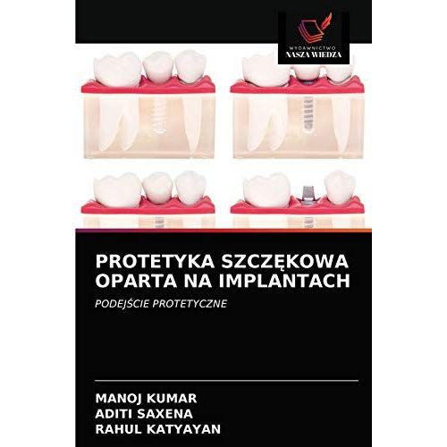 Protetyka Szcz¿Kowa Oparta Na Implantach