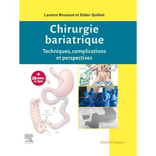Chirurgie Bariatrique