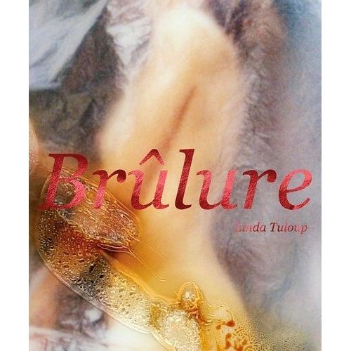 Brûlure