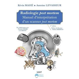 Radiologie Post Mortem - Manuel D'interprétation D'un Scanner Post Mortem