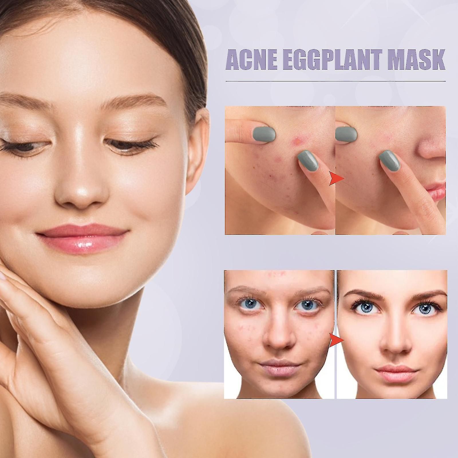 Pices Bton De Masque Au Th Vert Dissolvant De Points Noir... - 4