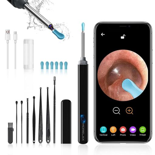 Kalanka-Otoscope Oreille, 1080p Hd - Camera Endoscope Auriculaire 3...