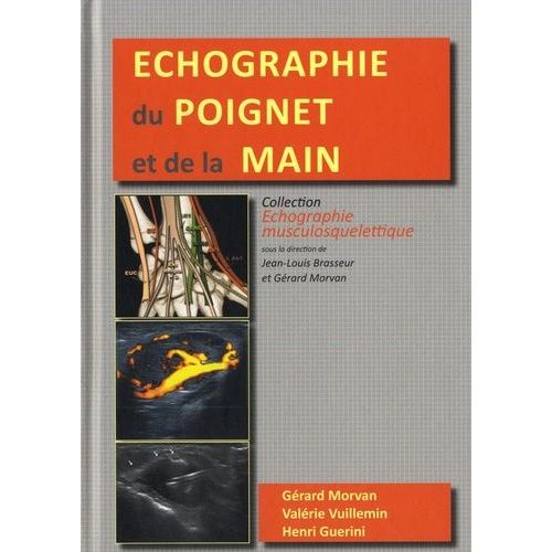Echographie Du Poignet Et De La Main