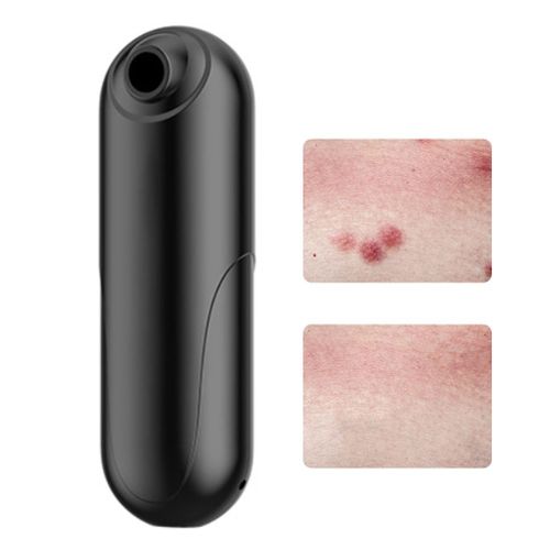 Hjlian Outil De Soulagement Des Demangeaisons Dues Aux Piqures D'insectes, Suceur De Piqures De Moustiques Rechargeable Par Usb, Sans Produits Chimiques, Pour Les Piqures D'insectes, D'abeilles Et De Guepes 