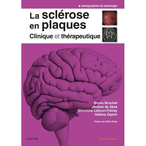 La Sclérose En Plaques - Clinique Et Thérapeutique