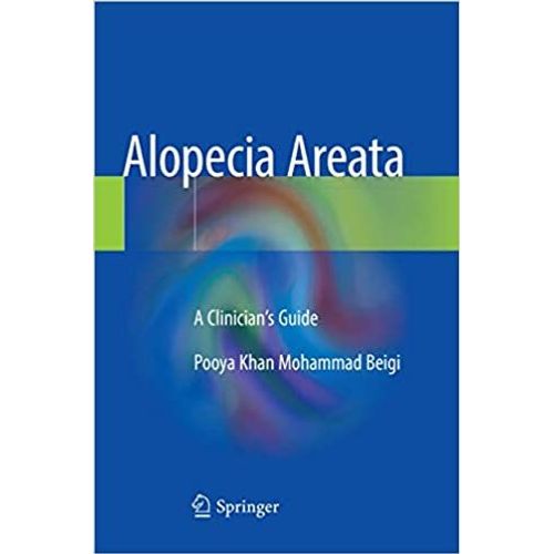 Alopecia Areata