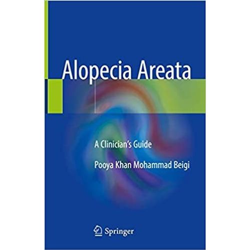 Alopecia Areata