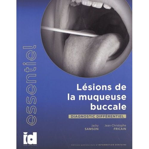 Lésions De La Muqueuse Buccale - Diagnostic Différentiel