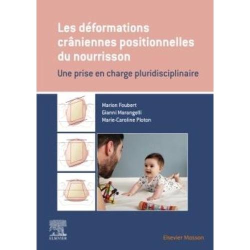 Les Déformations Crâniennes Positionnelles Du Nourrisson - Une Prise En Charge Pluridisciplinaire