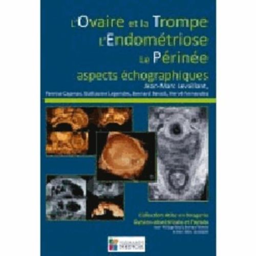 L'ovaire Et La Trompe, L'endométriose, Le Périnée - Aspects Échographiques