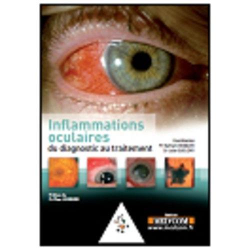 L'inflammation Oculaire