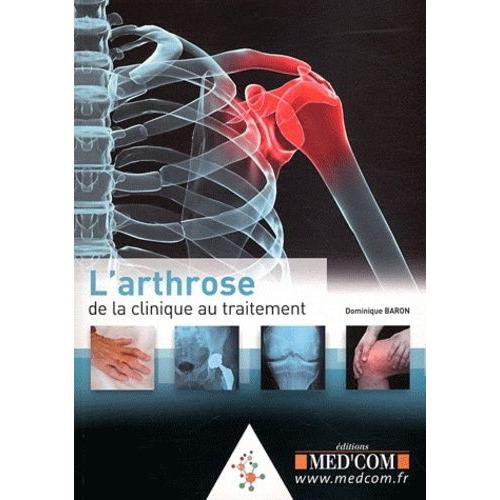 L'arthrose