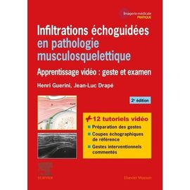 Infiltrations Échoguidées En Pathologie Musculosquelettique - Apprentissage Vidéo : Geste Et Examen