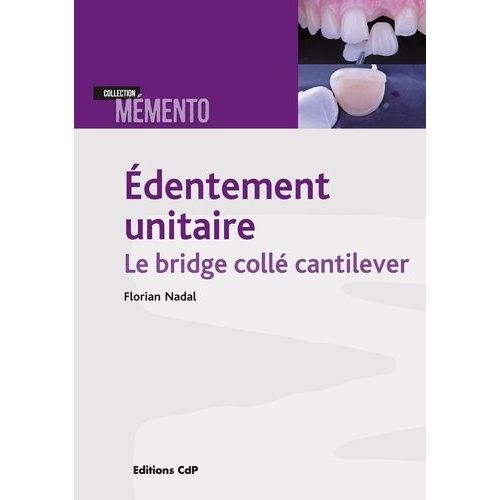 Edentement Unitaire : Le Bridge Collé Cantilever