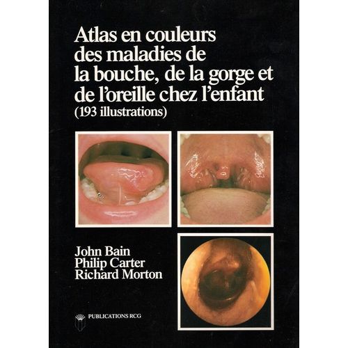 Atlas En Couleurs Des Maladies De La Bouche De La Gorge Et De L'oreille Chez L'enfant