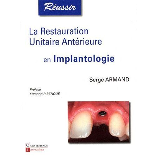 La Restauration Unitaire Antérieure En Implantologie