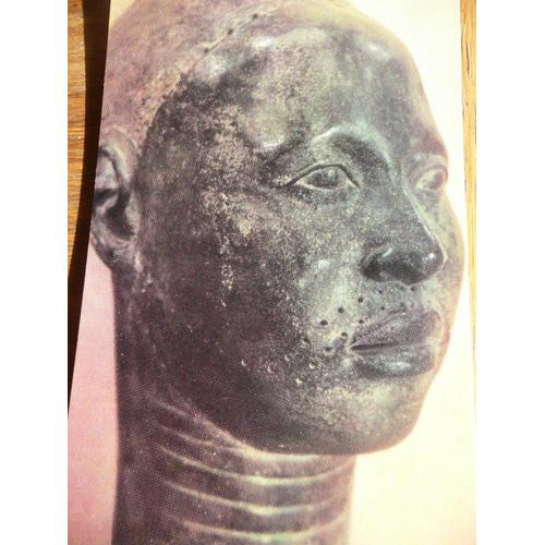 Sculpture D'ife Au Nigeria Publicité Originale Pour Micropore Steri Strip