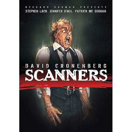 Scanners