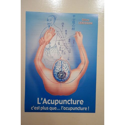L'acupuncture... C'est Plus Que L'acupuncture