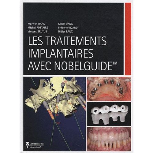 Les Traitements Implantaires Avec Nobelguide