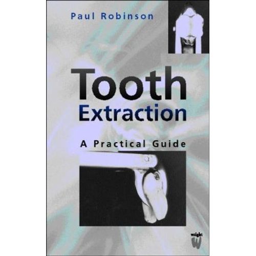Tooth Extraction: A Practical Guide
