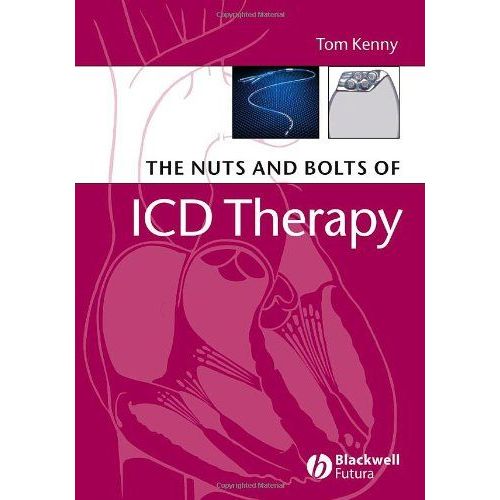 The Nuts And Bolts Of Icd Therapy