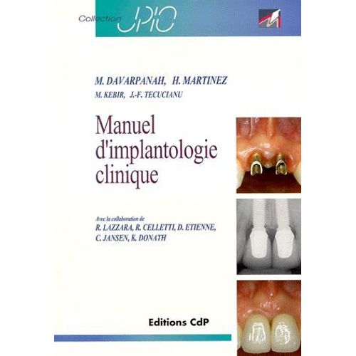 Manuel D'implantologie Clinique