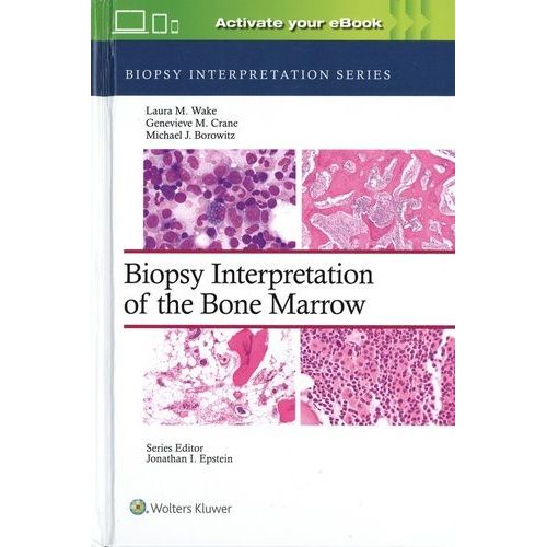 Biopsy Interpretation Of The Bone Marrow: Print + Ebook With Multimedia