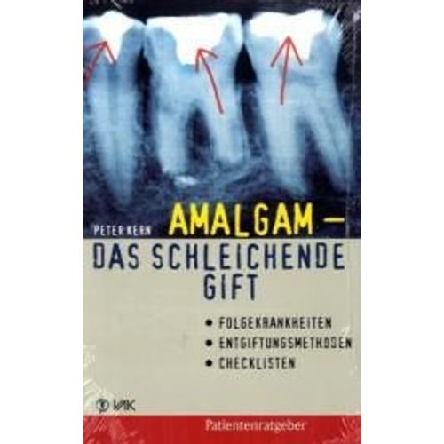 Amalgam - Das Schleichende Gift