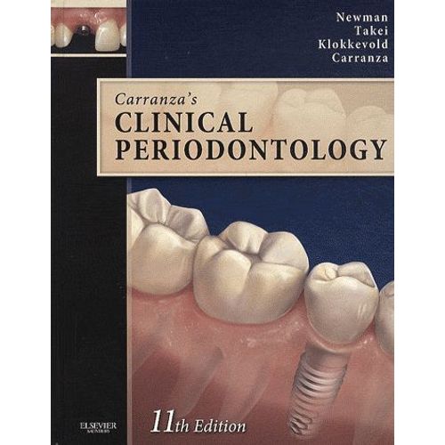 Carranza's Clinical Periodontology