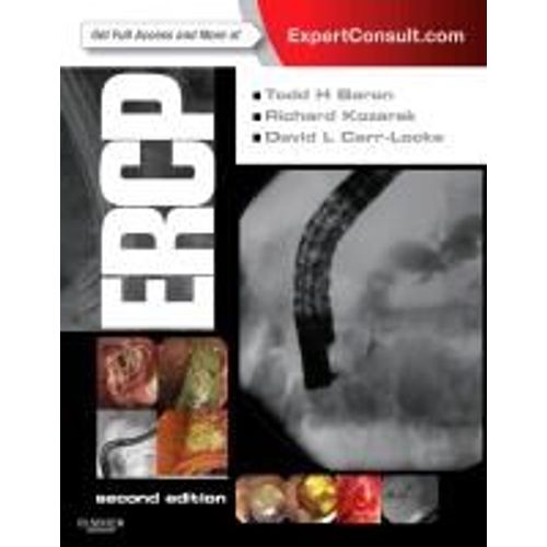 Ercp