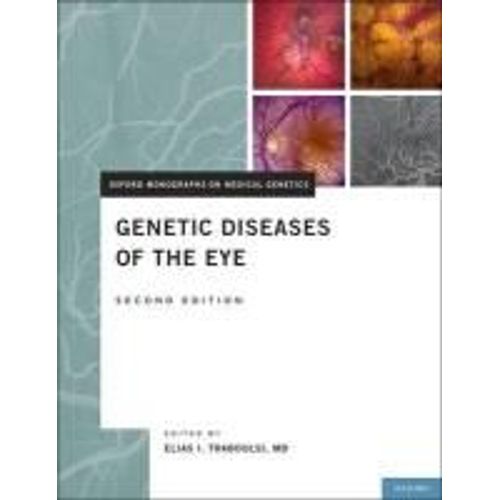 Genetic Diseases Of The Eye