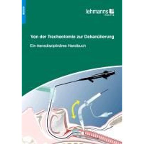 Von Der Tracheotomie Zur Dekanülierung