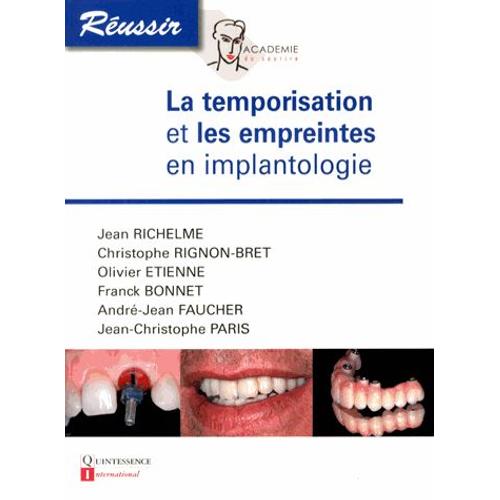 La Temporisation Et Les Empreintes En Implantologie