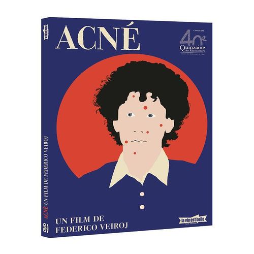 Acné