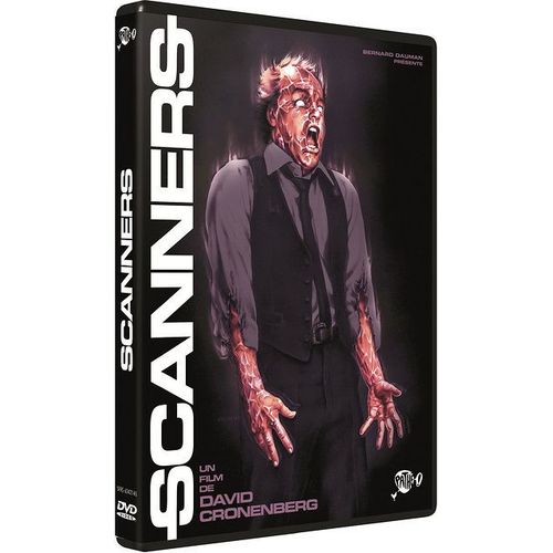 Scanners