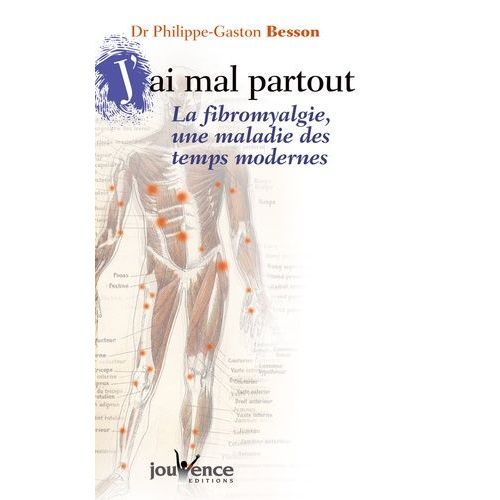 J'ai Mal Partout - La Fibromyalgie, Une Maladie Des Temps Modernes    Format Broch 