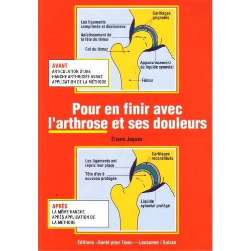 Pour En Finir Avec L' Arthrose Et Ses Douleurs   de liane jaques