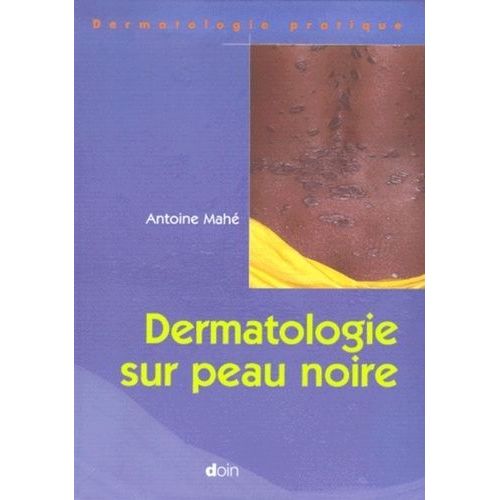 Dermatologie Sur Peau Noire Santé, Médecine Rakuten