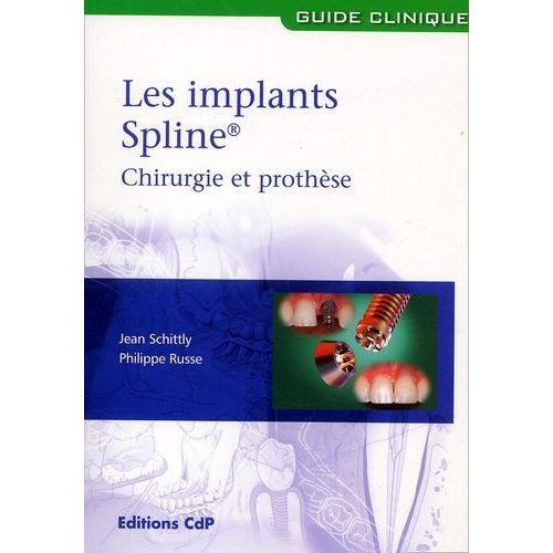 Les Implants Spline Chirurgie Et Prothèse Rakuten