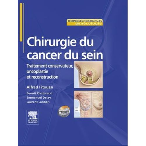 Chirurgie Du Cancer Du Sein  
