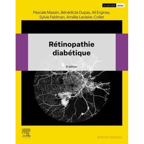 Rtinopathie Diabtique  
