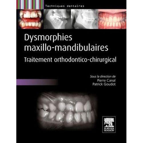 Dysmorphies Maxillo-Mandibulaires  