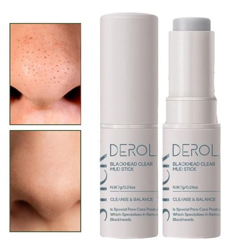 Bton Dissolvant De Points Noirs  Base De Plantes, Bton De Boue Transparent, Crme Pour Le Visage Dlicate Et claircissante Pour liminer Les Points Noirs Et 7g
